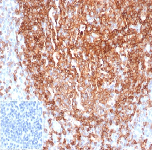 CD22/BL-CAM Antibody in Immunohistochemistry (Paraffin) (IHC (P))