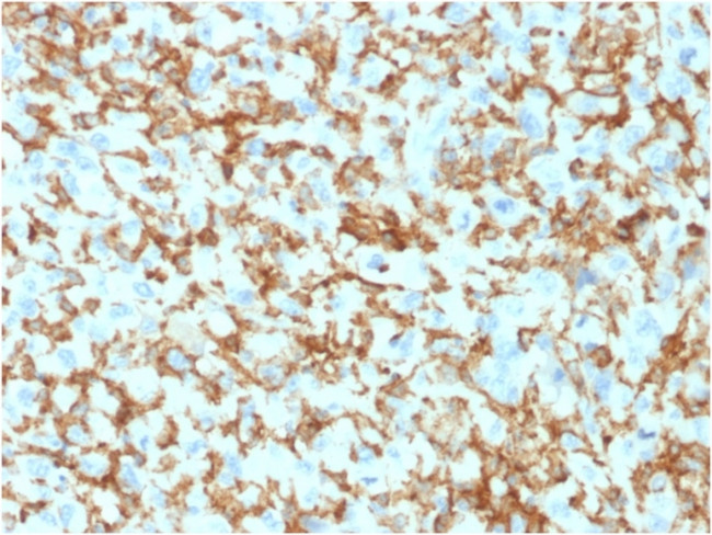 CD163 (Monocyte and Macrophage Marker) Antibody in Immunohistochemistry (Paraffin) (IHC (P))
