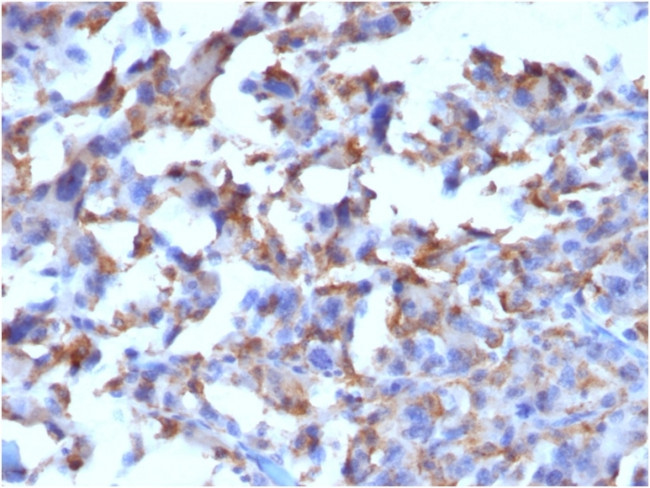 CD163 (Monocyte and Macrophage Marker) Antibody in Immunohistochemistry (Paraffin) (IHC (P))