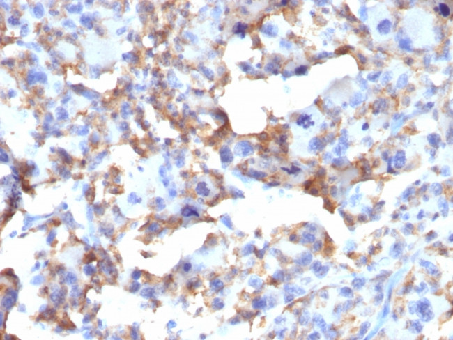 CD163 Antibody in Immunohistochemistry (Paraffin) (IHC (P))