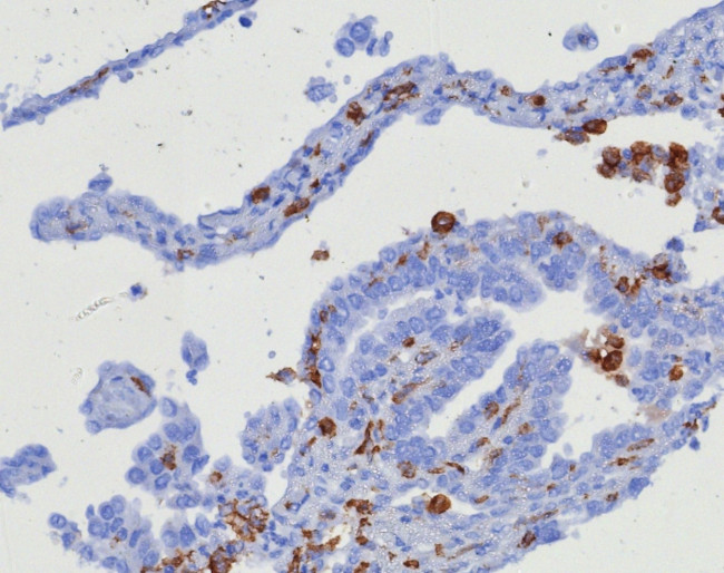 CD163 (Monocyte and Macrophage Marker) Antibody in Immunohistochemistry (Paraffin) (IHC (P))