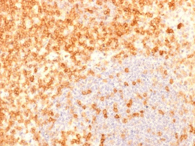 CD27 (Tumor Necrosis Factor Receptor Superfamily 7) Antibody in Immunohistochemistry (Paraffin) (IHC (P))
