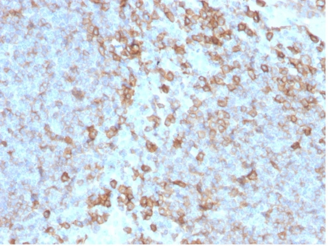 CD27 (Tumor Necrosis Factor Receptor Superfamily 7) Antibody in Immunohistochemistry (Paraffin) (IHC (P))