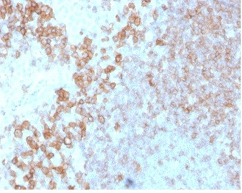 CD27 (Tumor Necrosis Factor Receptor Superfamily 7) Antibody in Immunohistochemistry (Paraffin) (IHC (P))