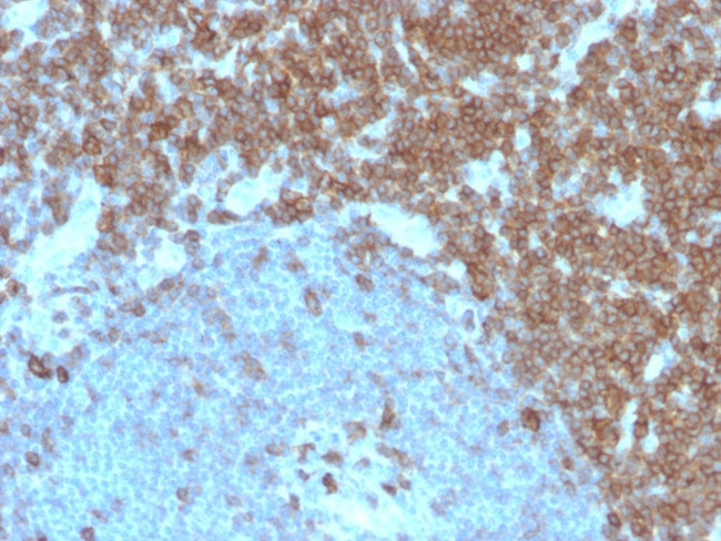 CD27 (Tumor Necrosis Factor Receptor Superfamily 7) Antibody in Immunohistochemistry (Paraffin) (IHC (P))