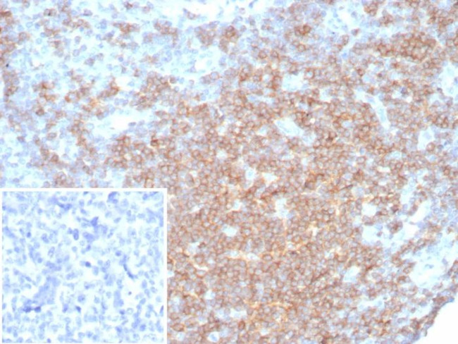 CD27 (Tumor Necrosis Factor Receptor Superfamily 7) Antibody in Immunohistochemistry (Paraffin) (IHC (P))