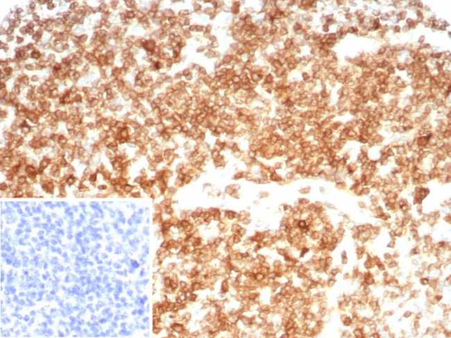CD27 (Tumor Necrosis Factor Receptor Superfamily 7) Antibody in Immunohistochemistry (Paraffin) (IHC (P))