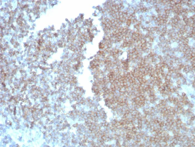 CD27 (Tumor Necrosis Factor Receptor Superfamily 7) Antibody in Immunohistochemistry (Paraffin) (IHC (P))