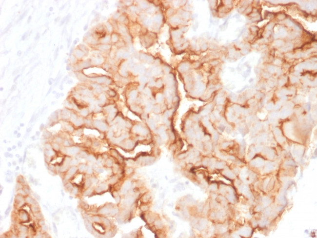 MUC16/CA125 Antibody in Immunohistochemistry (Paraffin) (IHC (P))