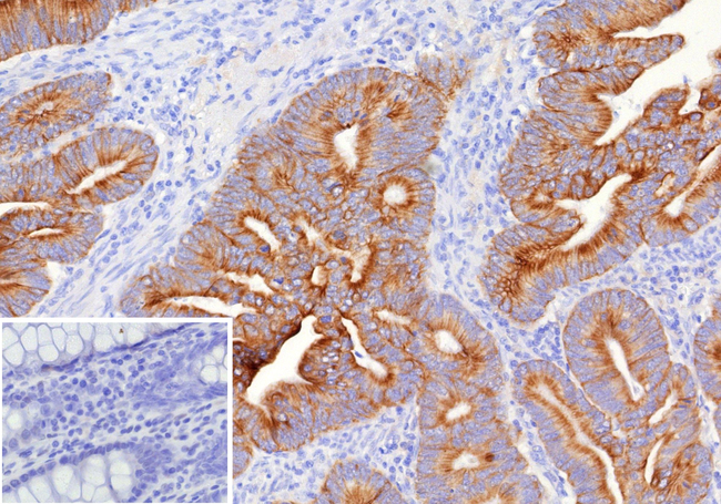 MUC16/CA125 (Ovarian Carcinoma Marker) Antibody in Immunohistochemistry (Paraffin) (IHC (P))