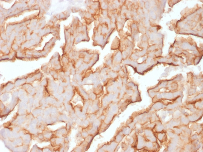 MUC16/CA125 Antibody in Immunohistochemistry (Paraffin) (IHC (P))