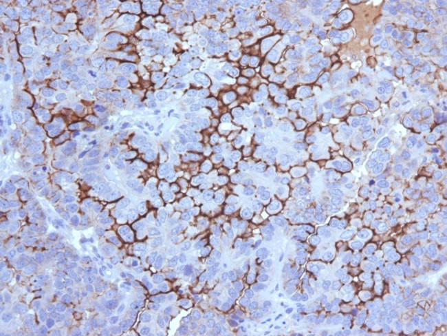 MUC16/CA125 (Ovarian Carcinoma Marker) Antibody in Immunohistochemistry (Paraffin) (IHC (P))