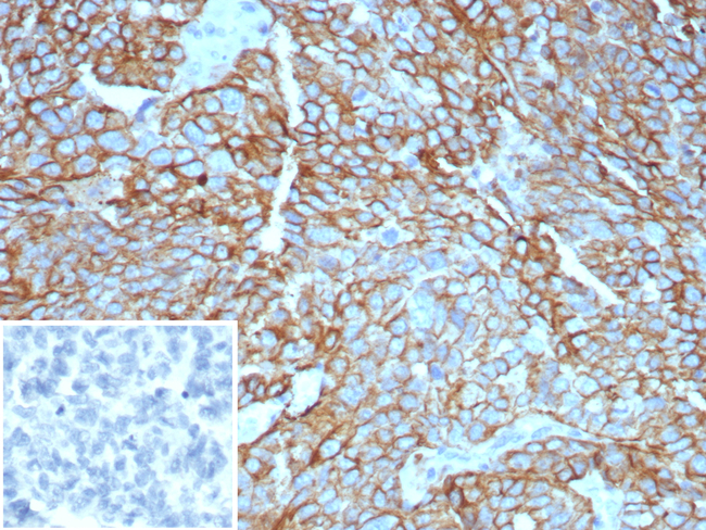MUC16/CA125 (Ovarian Carcinoma Marker) Antibody in Immunohistochemistry (Paraffin) (IHC (P))