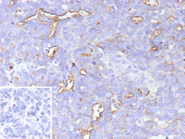 MUC16/CA125 (Ovarian Carcinoma Marker) Antibody in Immunohistochemistry (Paraffin) (IHC (P))
