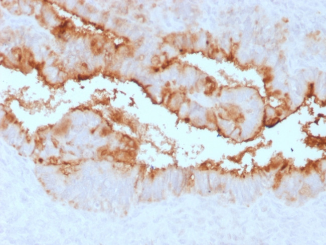 MUC16/CA125 Antibody in Immunohistochemistry (Paraffin) (IHC (P))