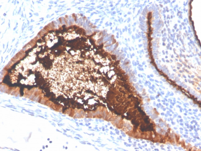 MUC16/CA125 (Ovarian Carcinoma Marker) Antibody in Immunohistochemistry (Paraffin) (IHC (P))