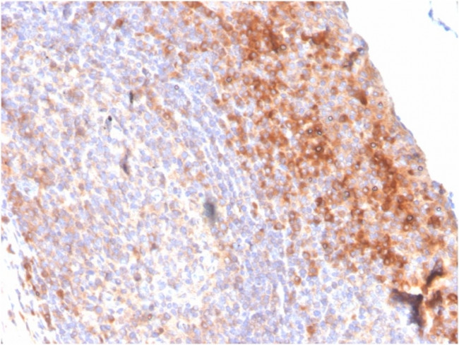 CD80 (B7-1) Antibody in Immunohistochemistry (Paraffin) (IHC (P))