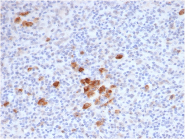 CD30/ TNFRSF8 (Hodgkin andReed-Sternberg Cell Marker) Antibody in Immunohistochemistry (Paraffin) (IHC (P))