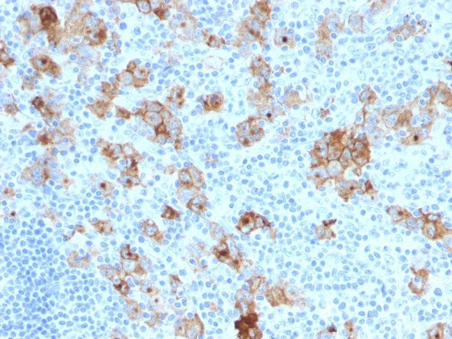 CD30/TNFRSF8 (Hodgkin & Reed-Sternberg Cell Marker) Antibody in Immunohistochemistry (Paraffin) (IHC (P))