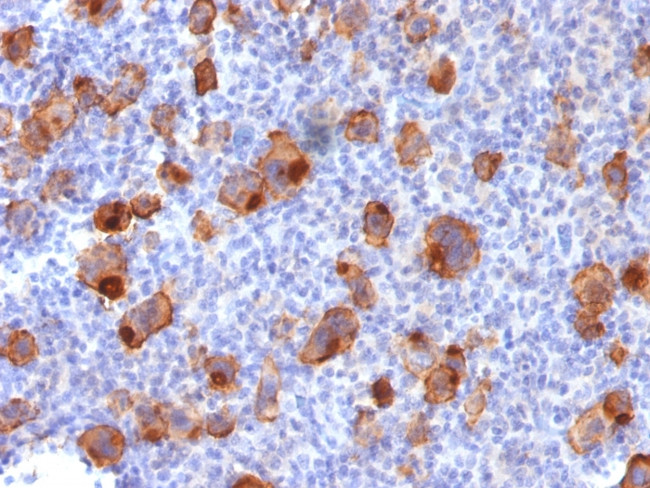 CD30/TNFRSF8 (Hodgkin and Reed-Sternberg Cell Marker) Antibody in Immunohistochemistry (Paraffin) (IHC (P))