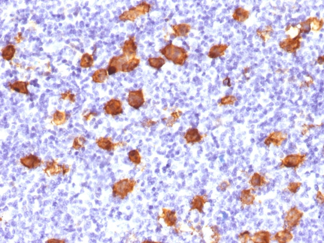 CD30/TNFRSF8 (Hodgkin and Reed-Sternberg Cell Marker) Antibody in Immunohistochemistry (Paraffin) (IHC (P))