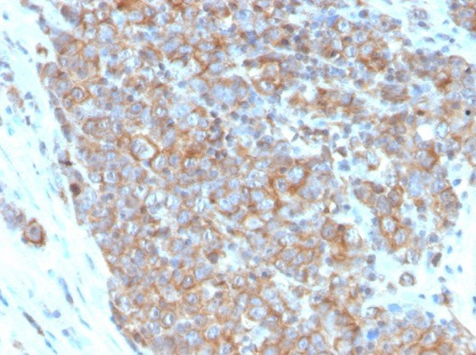 CD33/SIGLEC3 (Myeloid Cell Surface Antigen) Antibody in Immunohistochemistry (Paraffin) (IHC (P))