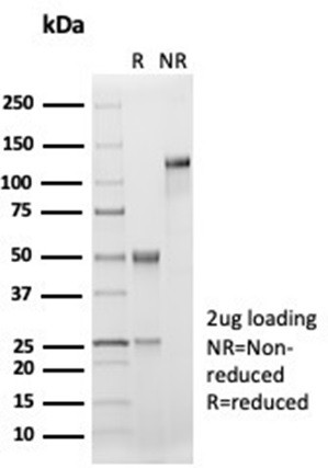 CD33/SIGLEC3 (Myeloid Cell Surface Antigen) Antibody in SDS-PAGE (SDS-PAGE)