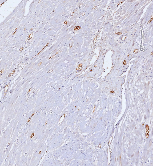 CD34 (Hematopoietic Stem Cell and Endothelial Marker) Antibody in Immunohistochemistry (Paraffin) (IHC (P))