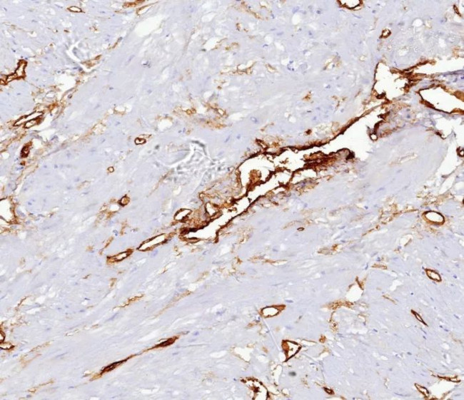 CD34 (Hematopoietic Stem Cell and Endothelial Marker) Antibody in Immunohistochemistry (Paraffin) (IHC (P))