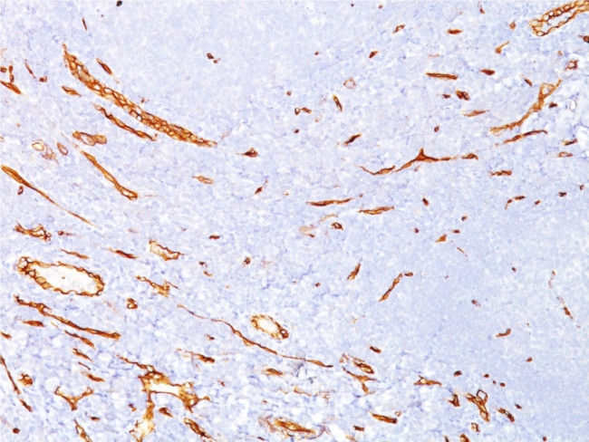 CD34 (Hematopoietic Stem Cell and Endothelial Marker) Antibody in Immunohistochemistry (Paraffin) (IHC (P))