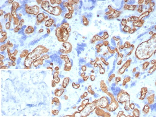 CD34 (Hematopoietic Stem Cell and Endothelial Marker) Antibody in Immunohistochemistry (Paraffin) (IHC (P))