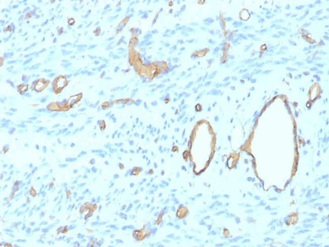 CD34 (Hematopoietic Stem Cell and Endothelial Marker) Antibody in Immunohistochemistry (Paraffin) (IHC (P))