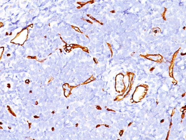 CD34 (Hematopoietic Stem Cell and Endothelial Marker) Antibody in Immunohistochemistry (Paraffin) (IHC (P))