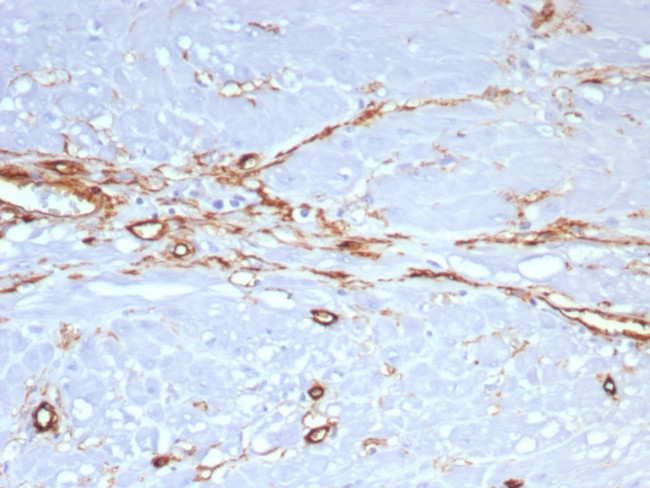 CD34 (Hematopoietic Stem Cell and Endothelial Marker) Monoclonal ...