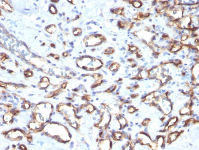 CD34 (Hematopoietic Stem Cell and Endothelial Marker) Antibody in Immunohistochemistry (Paraffin) (IHC (P))