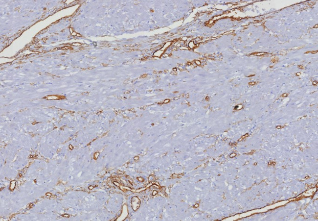 CD34 (Hematopoietic Stem Cell and Endothelial Marker) Antibody in Immunohistochemistry (Paraffin) (IHC (P))