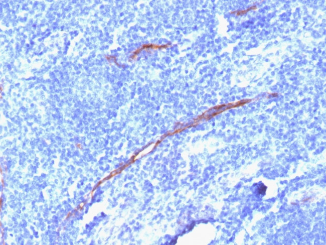 CD34 (Hematopoietic Stem Cell and Endothelial Marker) Antibody in Immunohistochemistry (Paraffin) (IHC (P))