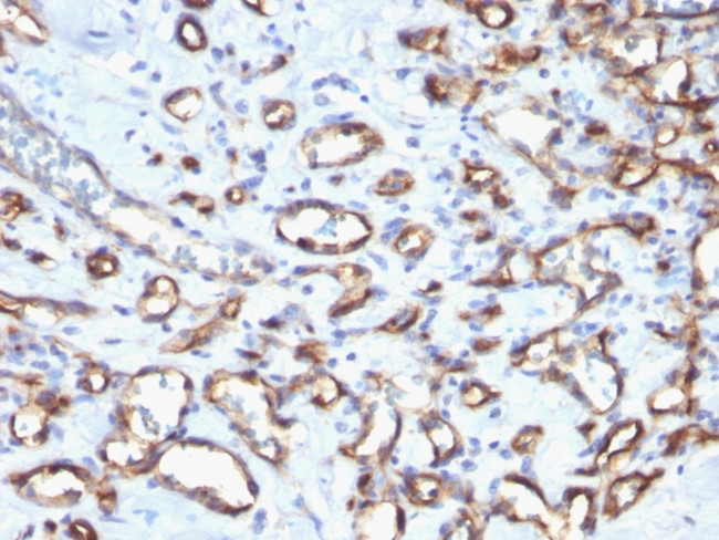 CD34 (Hematopoietic Stem Cell and Endothelial Marker) Antibody in Immunohistochemistry (Paraffin) (IHC (P))