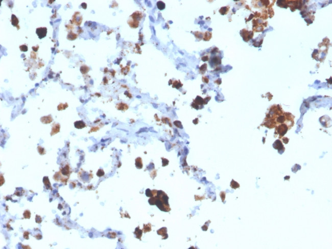 Napsin A Antibody in Immunohistochemistry (Paraffin) (IHC (P))
