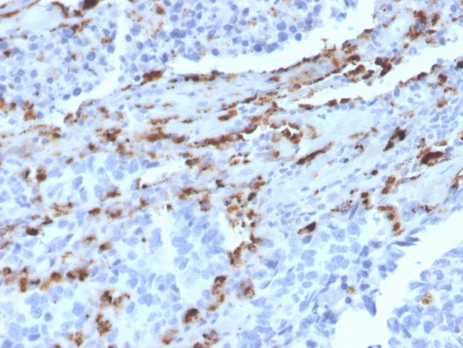 Napsin A (Lung Adenocarcinoma Marker) Antibody in Immunohistochemistry (Paraffin) (IHC (P))