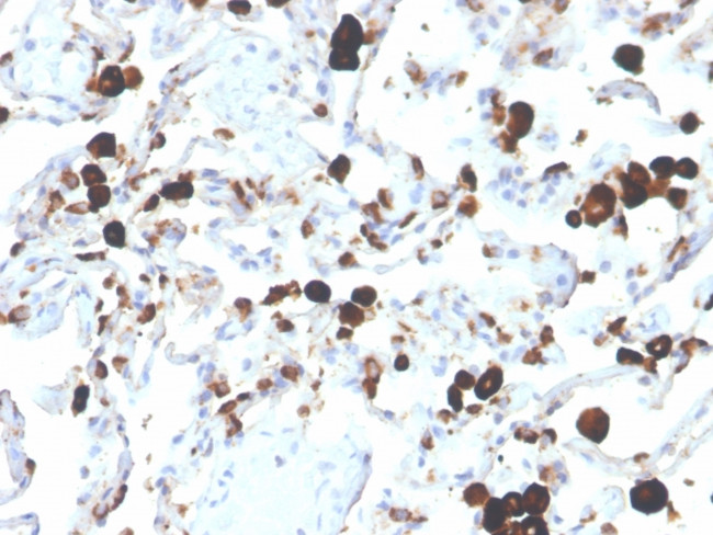 Napsin A Antibody in Immunohistochemistry (Paraffin) (IHC (P))