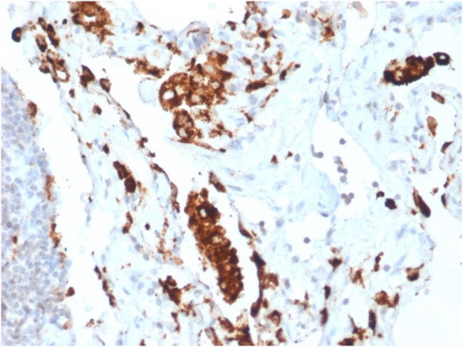 Napsin A Antibody in Immunohistochemistry (Paraffin) (IHC (P))