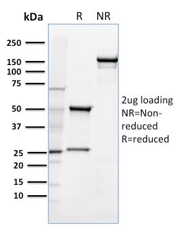 CD36 (Platelet and Microvessel Marker) Antibody in SDS-PAGE (SDS-PAGE)