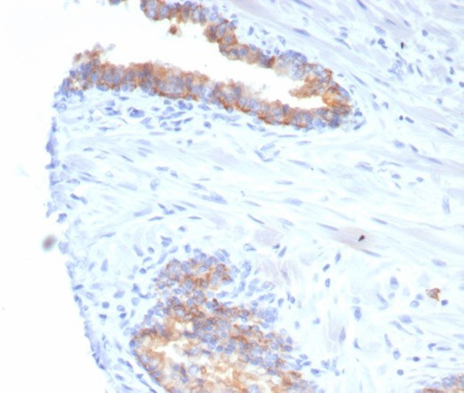 CD38 (ADP Ribosyl Cyclase I) Antibody in Immunohistochemistry (Paraffin) (IHC (P))