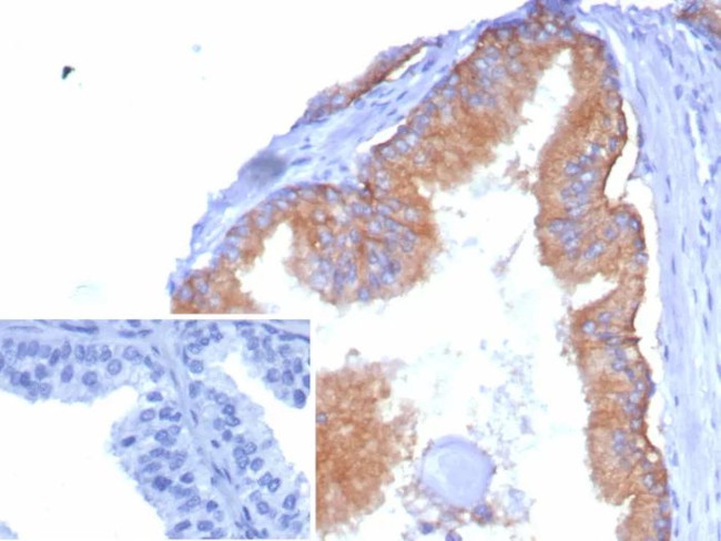 CD38 (ADP Ribosyl Cyclase I) Antibody in Immunohistochemistry (Paraffin) (IHC (P))