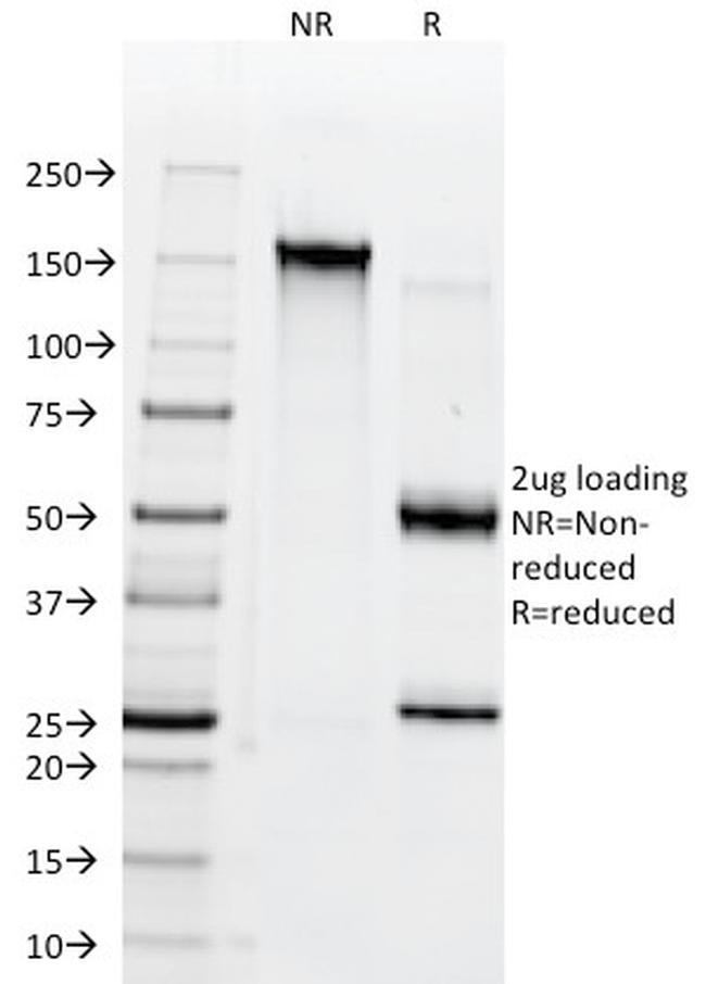 CD38 (ADP Ribosyl Cyclase I) Antibody in SDS-PAGE (SDS-PAGE)