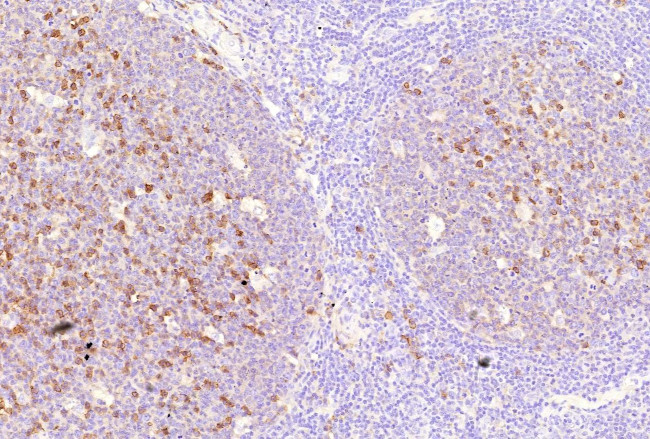 CD38 (ADP Ribosyl Cyclase I) Antibody in Immunohistochemistry (Paraffin) (IHC (P))