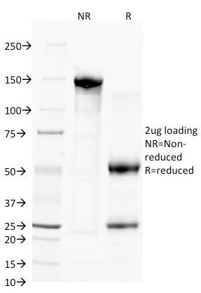 CD38 (ADP Ribosyl Cyclase 1) Antibody in SDS-PAGE (SDS-PAGE)