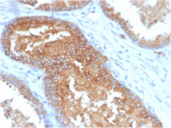 CD38 (ADP Ribosyl Cyclase I) Antibody in Immunohistochemistry (Paraffin) (IHC (P))