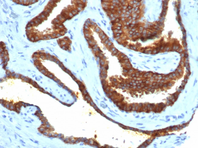 CD38 (ADP Ribosyl Cyclase I) Antibody in Immunohistochemistry (Paraffin) (IHC (P))